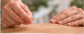 Certified Acupuncture